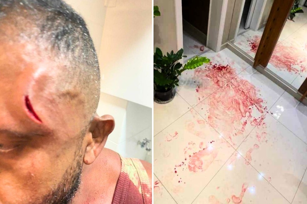 Fotos mostram deputado Da Cunha ferido, sangue em apartamento e roupas da ex-companheira danificadas