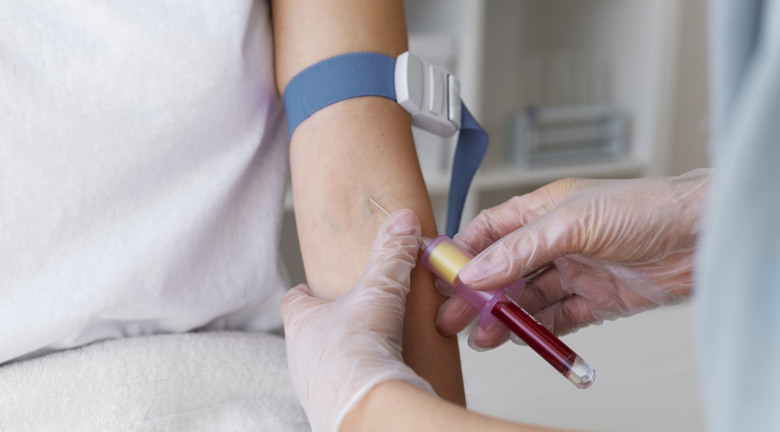 Outras doenças hematológicas também estão relacionadas ao câncer sanguíneo, além da leucemia
